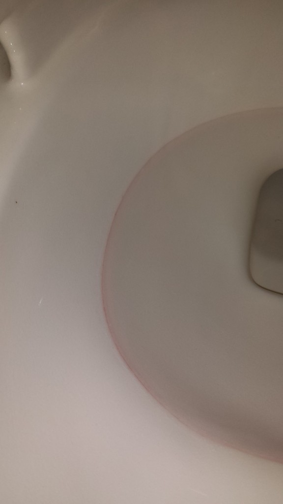 トイレのピンクの汚れをこすらずにキレイにする方法
